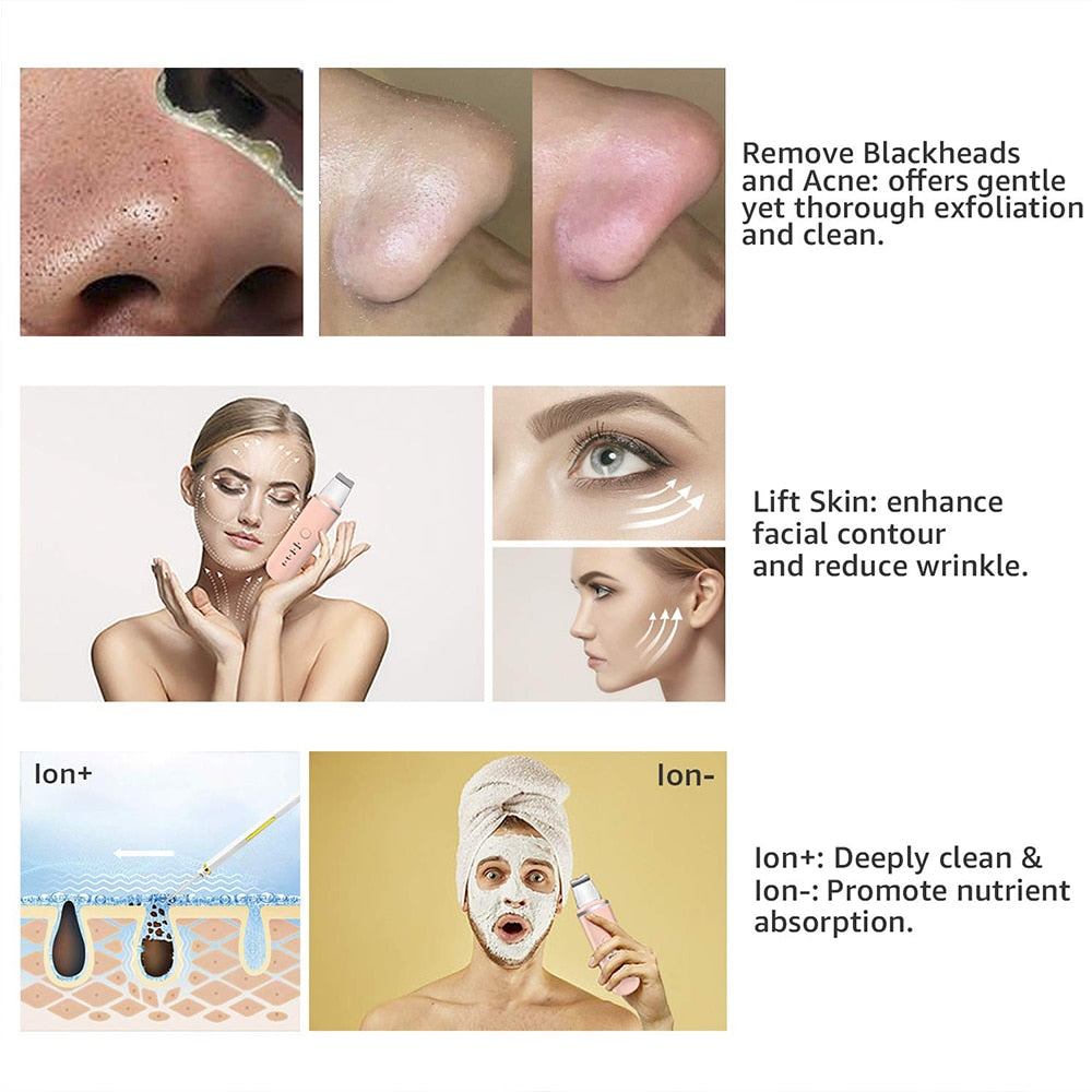 Ultrasonic Skin Scrubber Facial